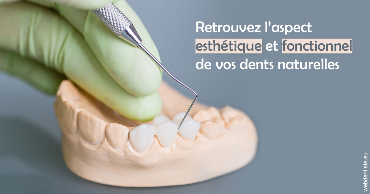 https://dr-baudelot-olivier.chirurgiens-dentistes.fr/Restaurations dentaires 1