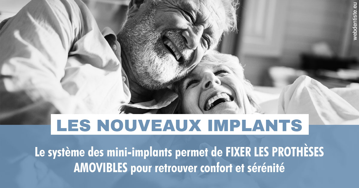 https://dr-baudelot-olivier.chirurgiens-dentistes.fr/Les nouveaux implants 2