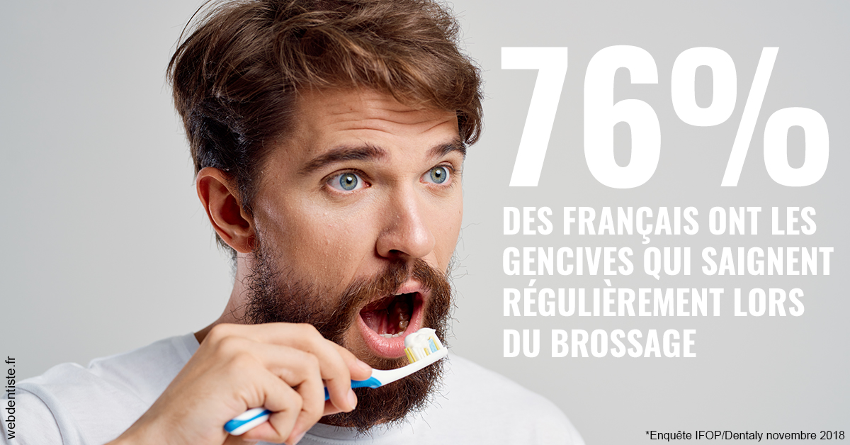 https://dr-baudelot-olivier.chirurgiens-dentistes.fr/76% des Français 2