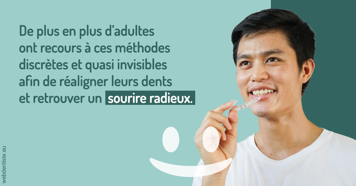 https://dr-baudelot-olivier.chirurgiens-dentistes.fr/Gouttières sourire radieux 2