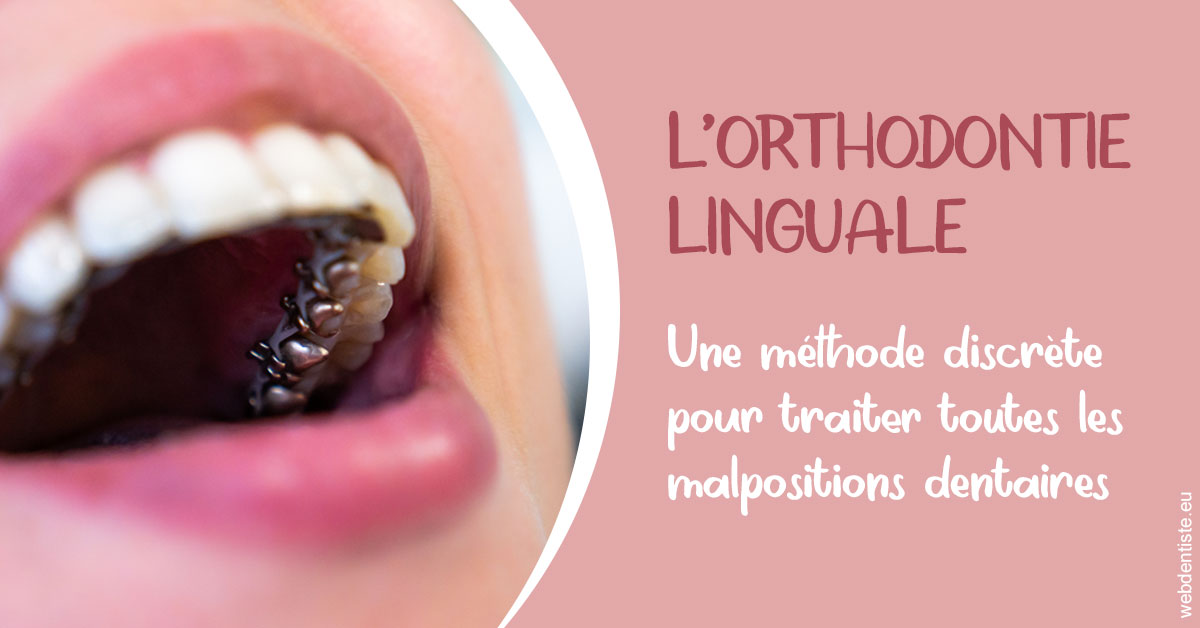https://dr-baudelot-olivier.chirurgiens-dentistes.fr/L'orthodontie linguale 2