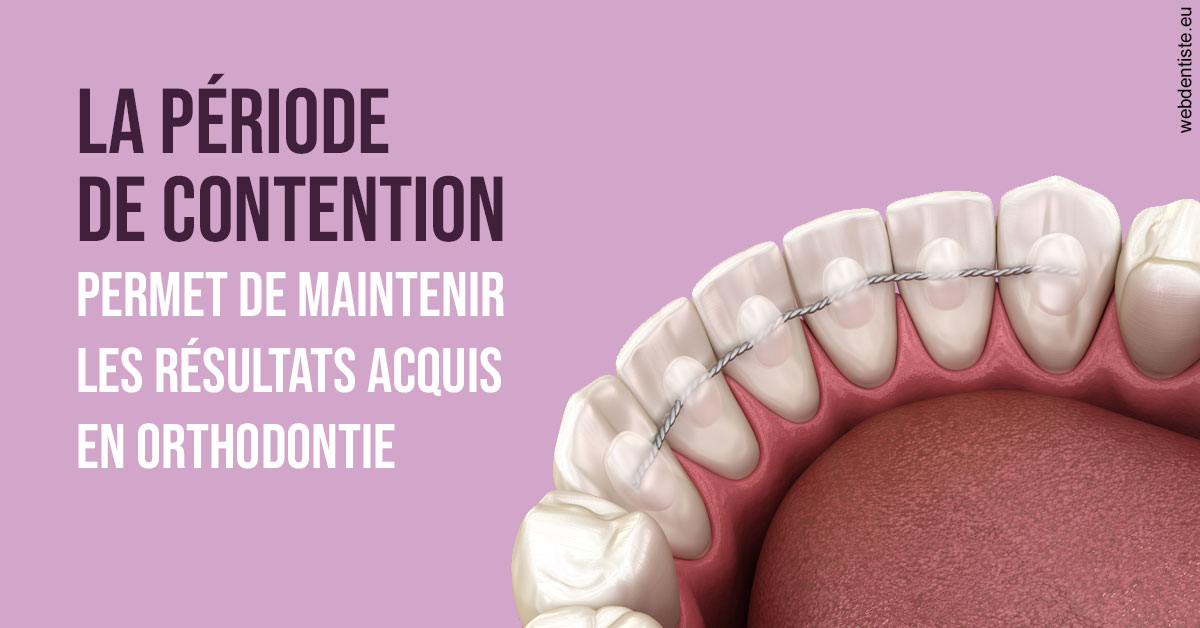 https://dr-baudelot-olivier.chirurgiens-dentistes.fr/La période de contention 2