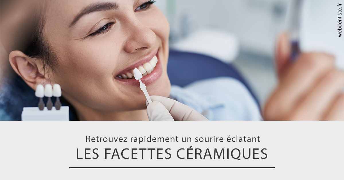 https://dr-baudelot-olivier.chirurgiens-dentistes.fr/Les facettes céramiques 2