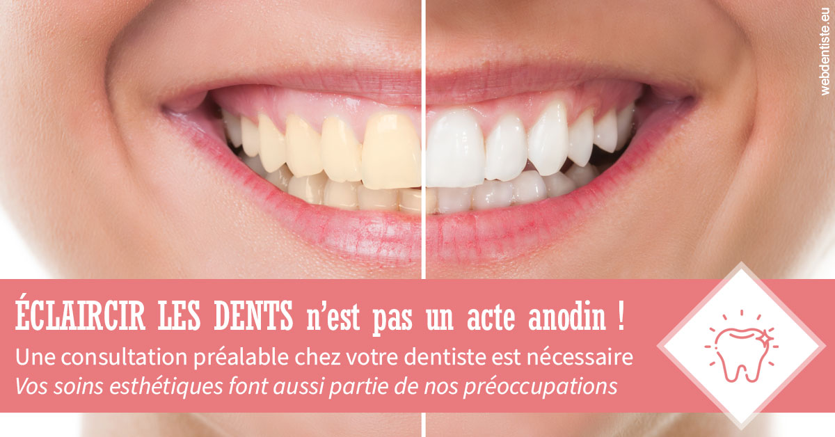 https://dr-baudelot-olivier.chirurgiens-dentistes.fr/Eclaircir les dents 1