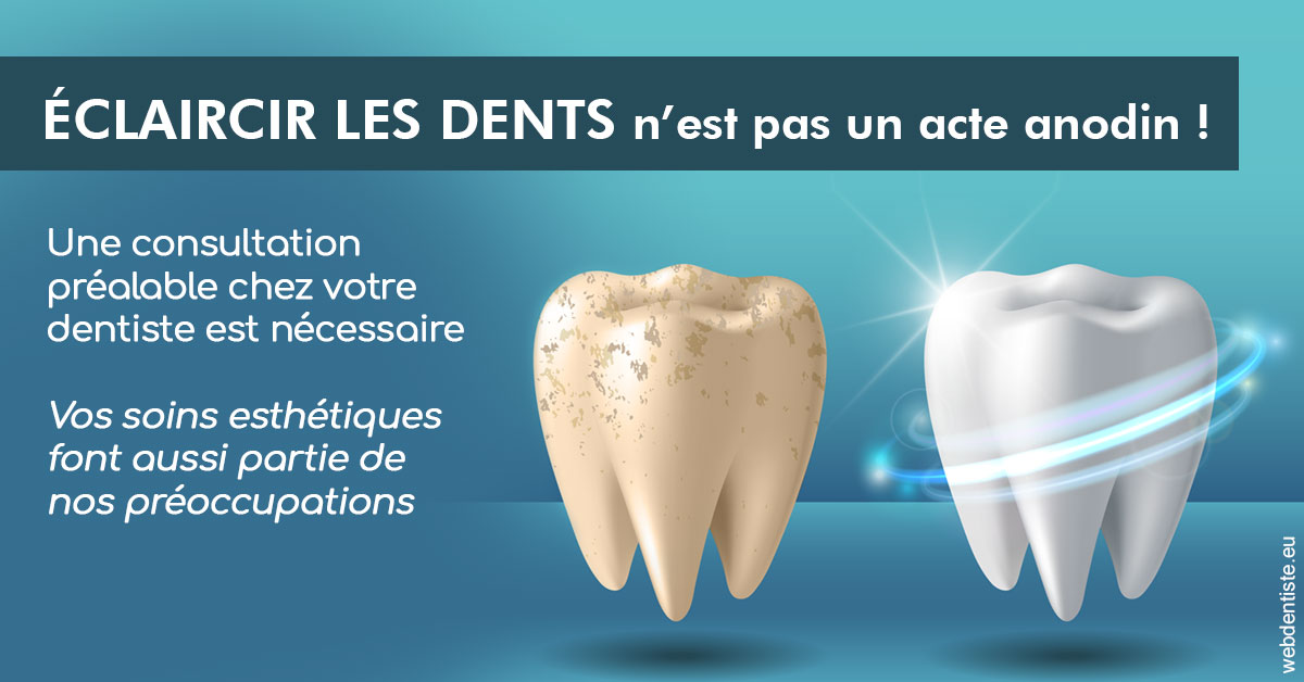 https://dr-baudelot-olivier.chirurgiens-dentistes.fr/Eclaircir les dents 2