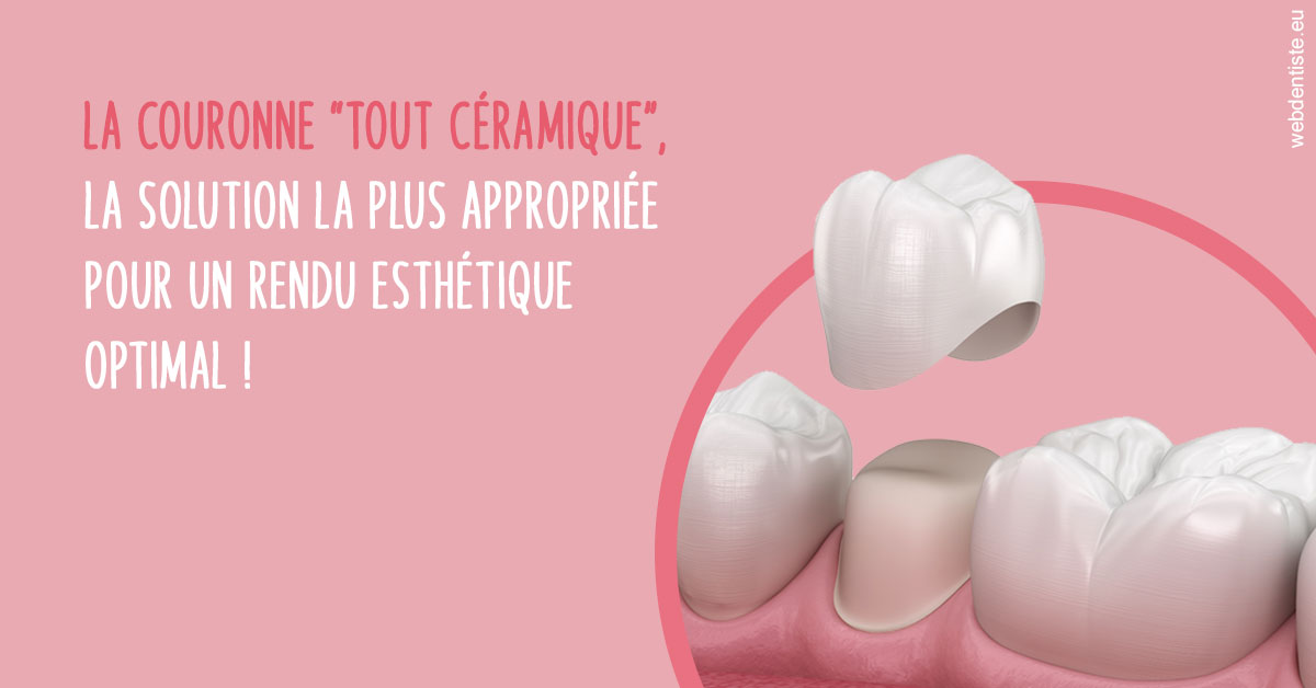 https://dr-baudelot-olivier.chirurgiens-dentistes.fr/La couronne "tout céramique"