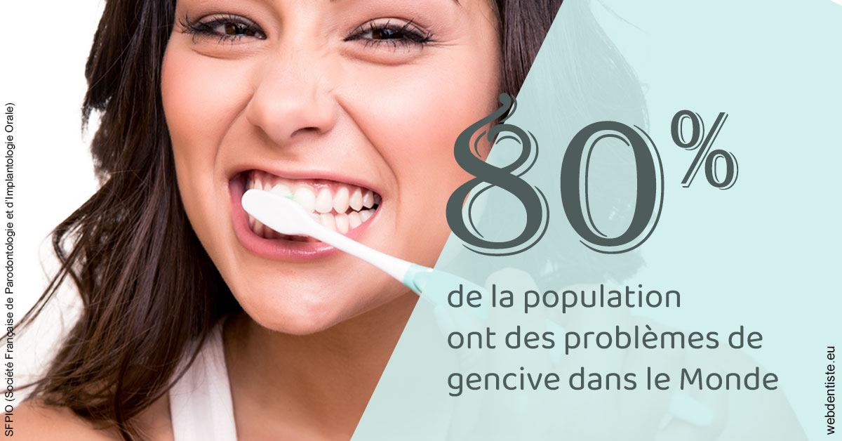 https://dr-baudelot-olivier.chirurgiens-dentistes.fr/Problèmes de gencive 1