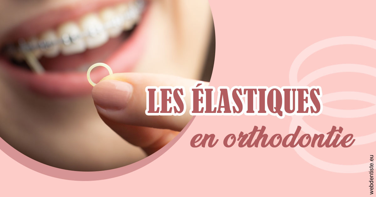 https://dr-baudelot-olivier.chirurgiens-dentistes.fr/Elastiques orthodontie 1