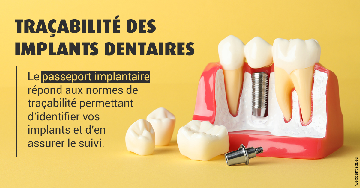 https://dr-baudelot-olivier.chirurgiens-dentistes.fr/T2 2023 - Traçabilité des implants 2