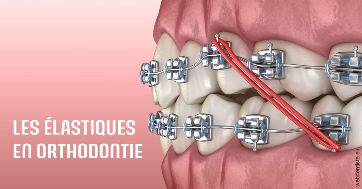 https://dr-baudelot-olivier.chirurgiens-dentistes.fr/Elastiques orthodontie 2