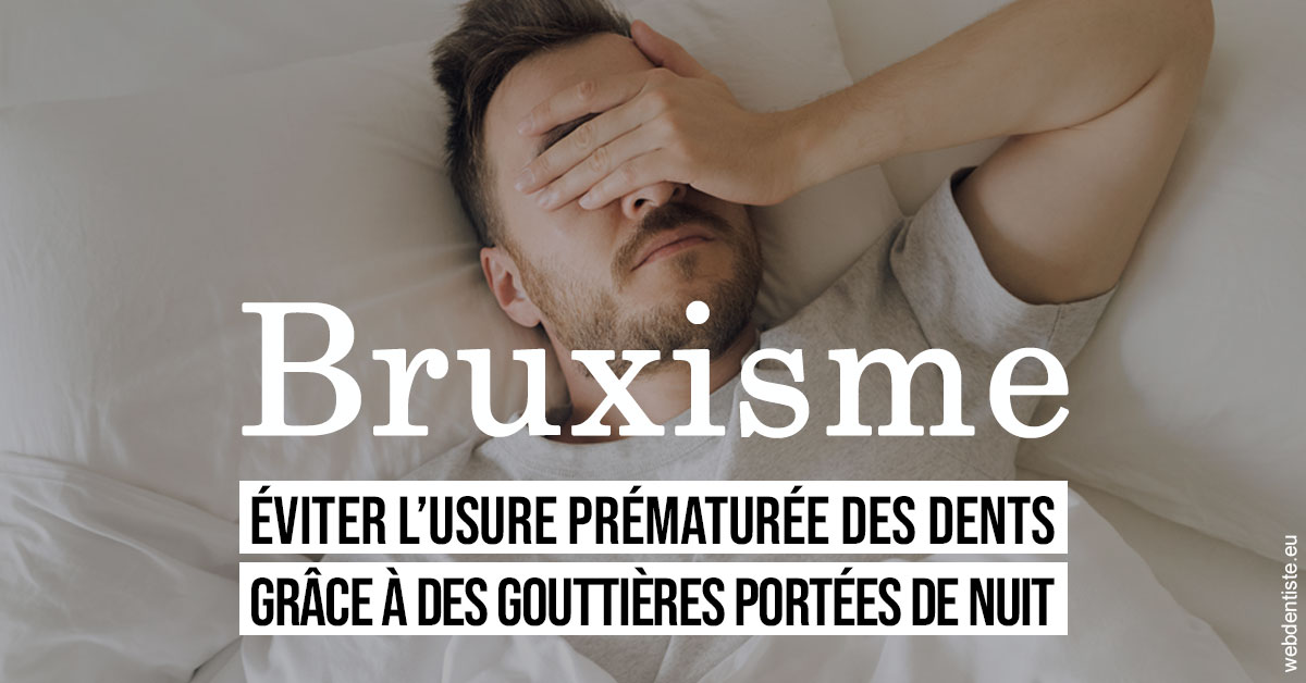 https://dr-baudelot-olivier.chirurgiens-dentistes.fr/Bruxisme 1