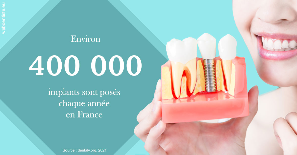 https://dr-baudelot-olivier.chirurgiens-dentistes.fr/Pose d'implants en France 2